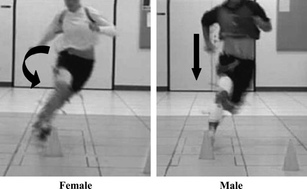 Clin J Sport Med Volume 17, Number 1, January 2007 Gender Difference in Kinematics and Kinetics FIGURE 2.