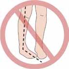 Be careful ot to let your leg tur iward while gettig ito or out of a bed or car. Do ot cross your leg past the middle of your body Do ot cross your kees or akles.
