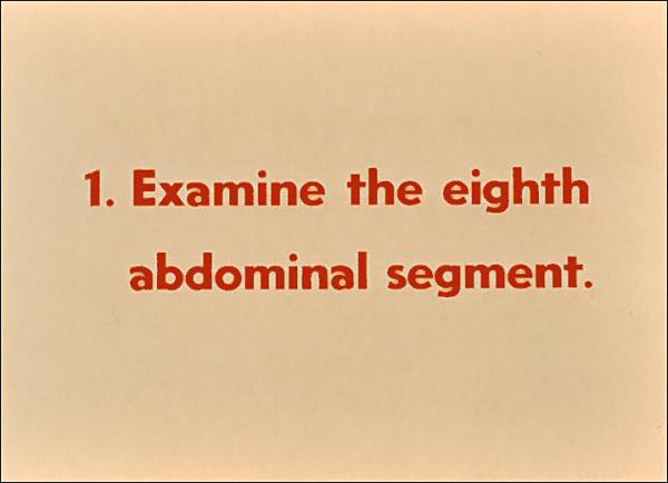 Slide 62 Slide 62 First, examine the eighth abdominal segment for the presence or absence