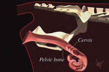 The cervix is located on the floor of the pelvic cavity near the anterior end of the pelvic bone. As you insert the breeding gun into the vagina, keep your gloved hand even with the gun tip.