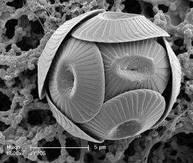 Coccolithophore Blooms in Bering Sea