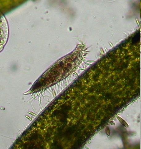 They all have cilia: The Spirostomum use