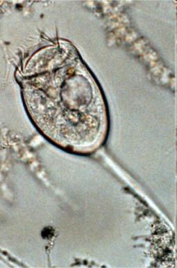 The Stylonychia use their cilia to crawl