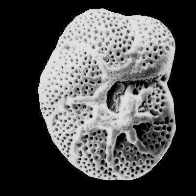 Foraminifera A unicellular Protist.