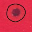 Salmonella Species Colony Color Colony Metabolism Red Dark Red Brown Yellow Zone