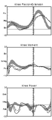 excessive equinus in swing Trim line posterior to medial and lateral malleolus Thinner ankle coverage that allows sagittal plane motion in dorsiflexion during weight bearing Support strapping at