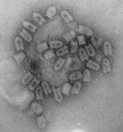 Outbreaks of Spring Viraemia of Carp in UK