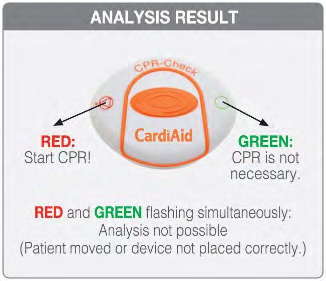 CardiAid ECC Assistant CardiAid External Chest Compression (ECC) Assistant is designed to help the rescuer perform the most effective and consistent chest compressions.