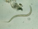Hookworm s feed on the blood of the host.