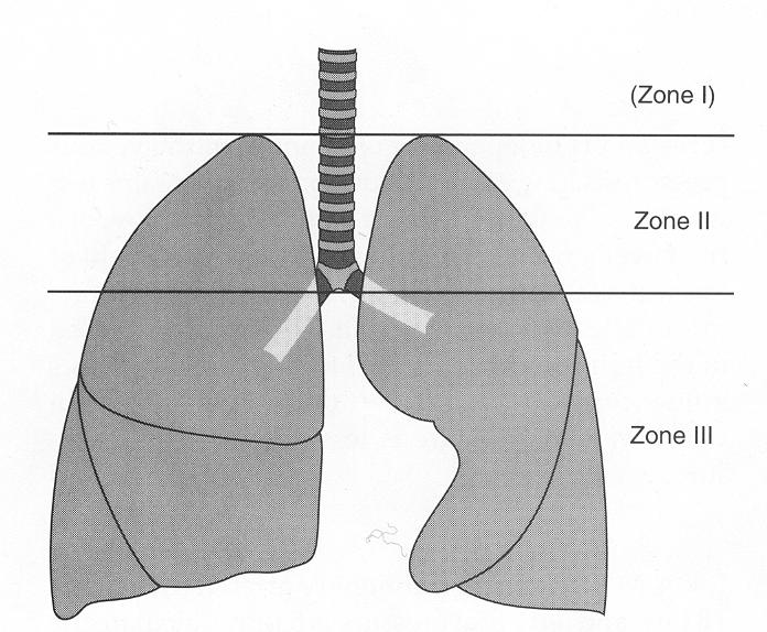 healthy people Bedrest puts every lung region in Zone