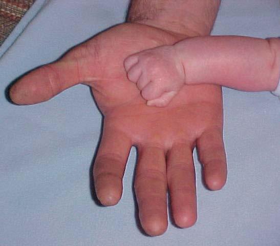 Your Gift from Birth At birth you are only given two hands made up of : 2 Thumbs