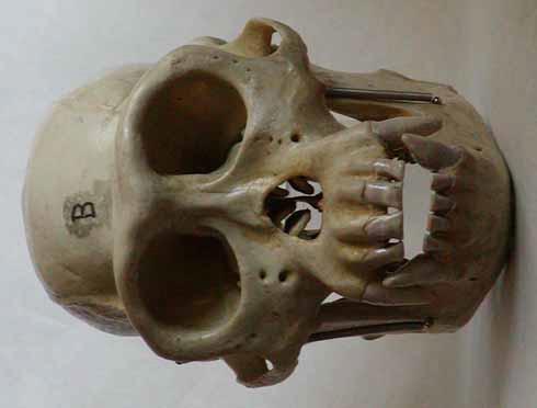 The brain cavity of a chimpanzee s skull is much small than a human s, with the teetch