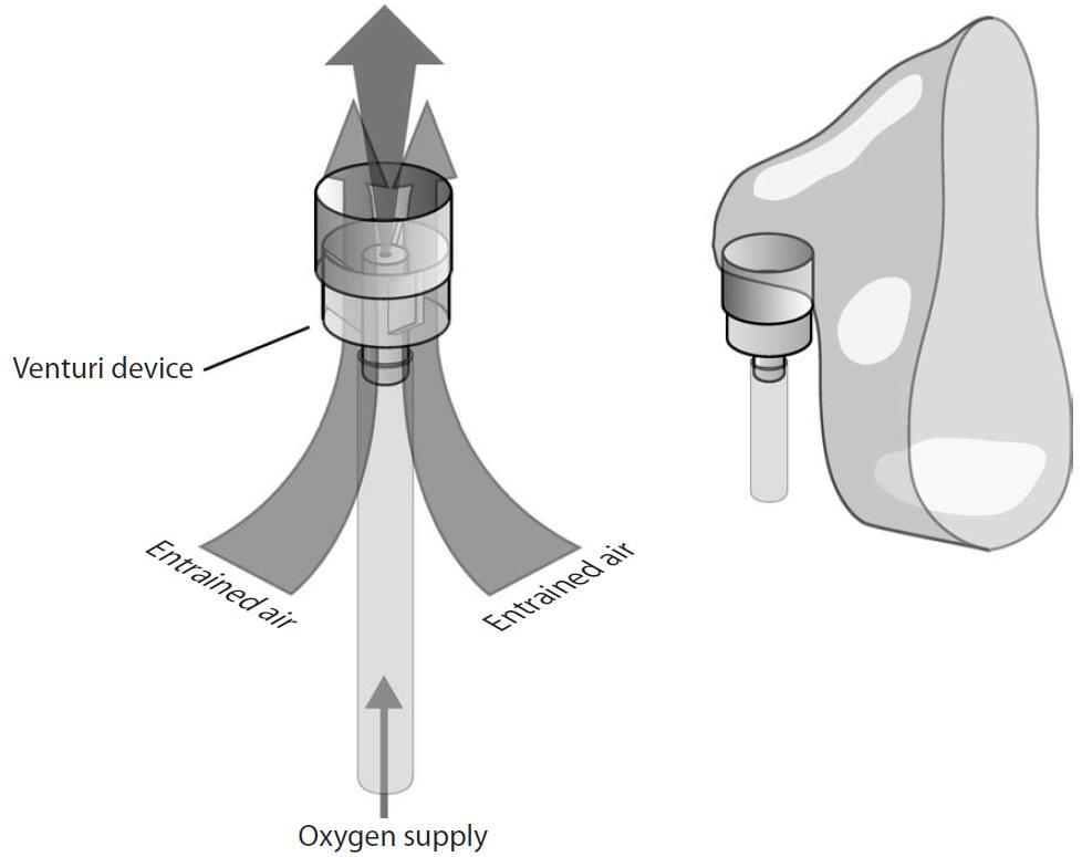 Venturi Mechanism If oxygen is supplied to the venturi device at the correct flow rate, air will