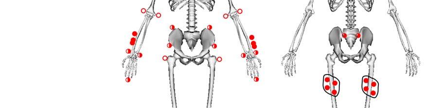 XY-plane: Plane fit through anterior superior iliac spines and midpoint