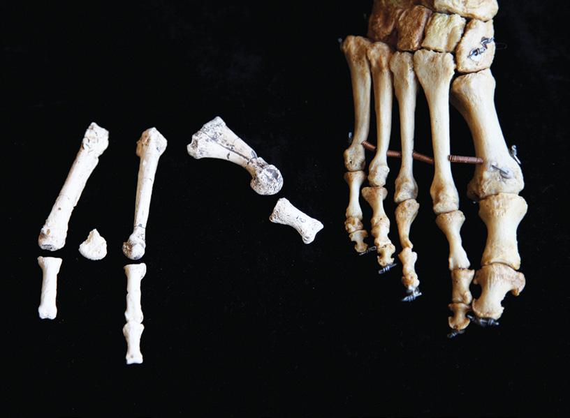 A FOOT APART: Partial fossil foot from the site of Burtele in Ethiopia (left) had a divergent big toe and other traits that distinguish it from the feet of modern humans (right) and their ancestors,