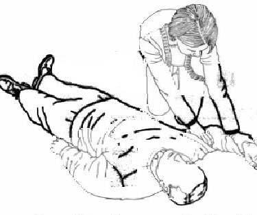 OPENING THE AIRWAY The Recovery Position Obstructed Airway Head Tilt Chin Lift 1 Kneel beside the casualty.