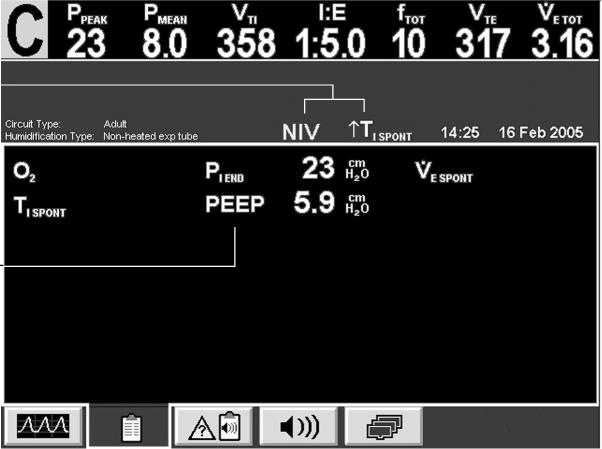 NIV and 1T I SPONT indicators on More patient data subscreen. Hidden if two or more alarms present.