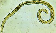 (5) Round worms (Phylum Nematoda) Cylindrical in shape, tapered at both ends Tough cuticle covers the body Sexual reproduction,