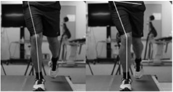 Common Deviations Pelvic/Hip Excessive contralateral drop Hip adduction