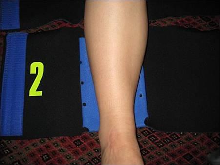 STEP 4 Apply segment pair #2 on the patient s ankles. Apply segment pair #2 on the patient s ankles STEP 5 Apply segment pair #3 to the thighs, as on an average height woman.