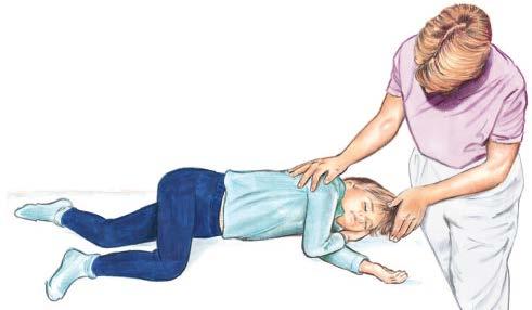 Recovery Position If the child is breathing & there is no