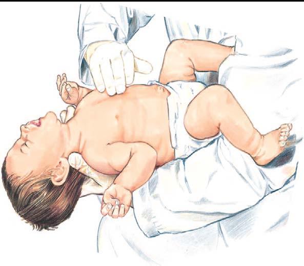 2-finger Chest Compression Technique in Infant For lay rescuers