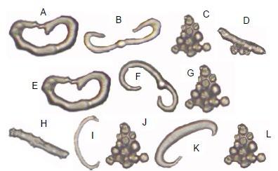 10): ventral body wall: O-shape (A), C-shape (B), miliary granules (C), rod (D); dorsal body wall: O-shape (E),