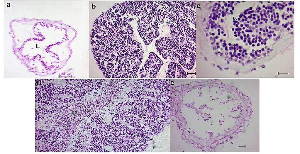 71 Figure 9. Photomicrography of histology of gonadal development of male Isostichopus sp. aff badionotus. a) Recovery.