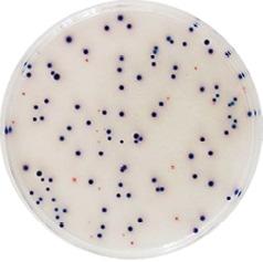 Rapid chromogenic methods COMPASS Enterococcus COMPASS Enterococcus allows the enumeration of Enterococcus spp. in human food products, consumption water and wastewaters.