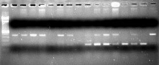 hydrophila từ mô gan/thận cá nhiễm kép được phát hiện bằng kỹ thuật PCR (M: thang chuẩn 100 bp;