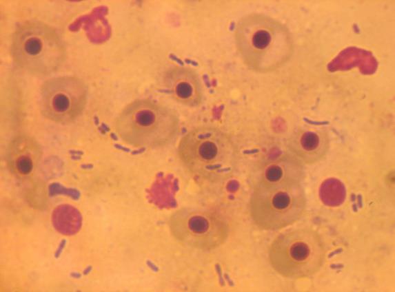19: Các mẫu phết kính cá nhiễm kép 2 loài vi khuẩn E. ictaluri và A.