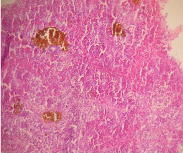 Ngoài ra, trên mô gan còn có các tĩnh mạch, động mạch, trung tâm đại thực bào sắc tố và các đảo tụy (Hình 4.24A).