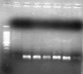 M 1 2 3 4 5 6 7 8 9 10 11 12 13 14 15 16 M 17 18 19 20 21 22 23 Hình 4.34: Kết quả PCR xác định các gen IntI1 ở vi khuẩn A. hydrophila và E. ictaluri.