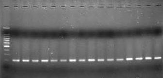 48: Phổ điện di sản phẩm PCR của gen kháng florfenicol ở vi khuẩn E. ictaluri và A. hydrophila. M: thang chuẩn 100 bp plus; giếng 1-15: thứ tự các chủng vi khuẩn E.