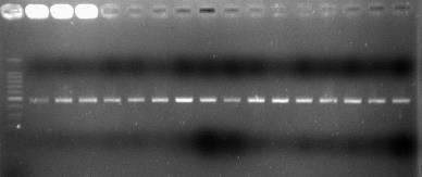 ictaluri với kích thước sản phẩm là 500 bp. Tương tự, Yuasa et al. (2003) cũng phát hiện vi khuẩn E. ictaluri với sản phẩm PCR là 530 bp. Đặc biệt, thời gian gần đây, Panangala et al.