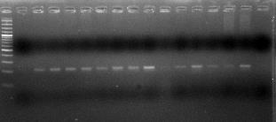 Bên cạnh đó, để xác định chính xác thì nghiên cứu cũng sử dụng kỹ thuật PCR để định danh các chủng vi khuẩn A. hydrophila phân lập được.
