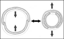 Figure 11: Concentric
