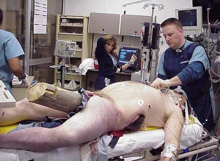 Now I ll leave you with some ravings from the Mad Angler This is an actual emergency room photo of a fisherman who lost control of his High Speed Bass Boat in West Virginia The warden's believe that