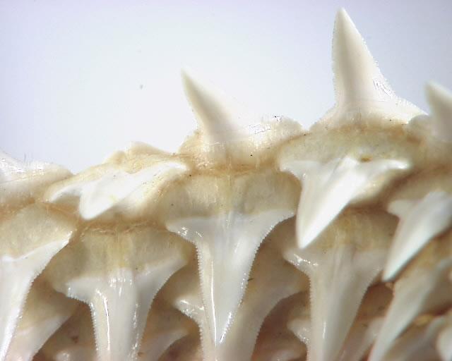 Teeth Structure