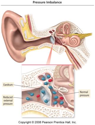 If there is a difference in pressure across the eardrum membrane, the