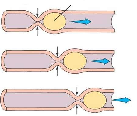 The following diagram shows the mechanism of peristalsis. Contraction of muscle behind food Food Activity 5 Collect: rubber tubing washing up liquid marble 1.