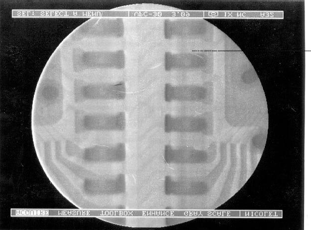 Figure 3 Figure 4 shows X-ray photographs of J leads and resistors.