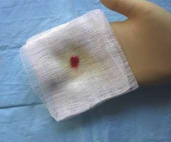 gauze If cerebrospinal fluid is