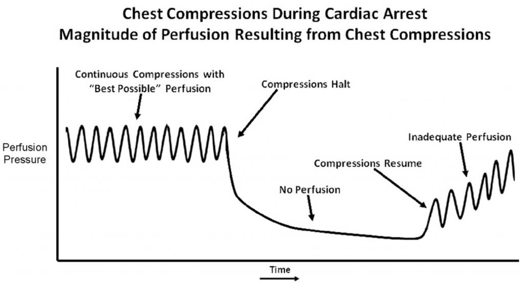 120 compressions/ minute First 10 comp = 5 sec (priming) 20