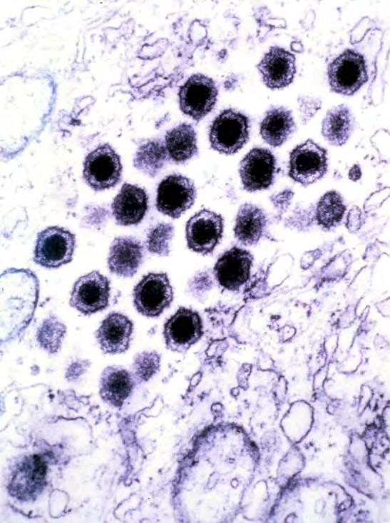 Epizootic haematopoietic necrosis virus Found only