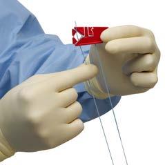 zip-line down stitch and push into join space Color free limb with surgical pen, prior to