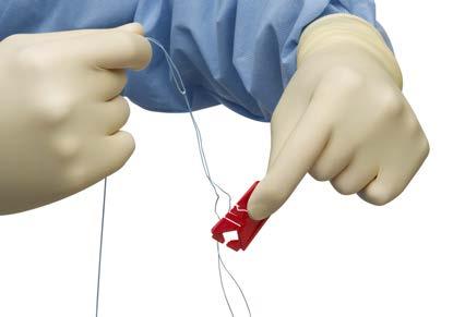 5 Remove Suture Card Simply rotate the wrist to remove remaining suture length from suture card Sutures do NOT