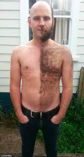 DAY 133 TV razor ad shows real body hair for first time A simple TV advertisement for a razor has created great debate and gone viral online.