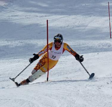 Para Alpine Medical Issues STANDING SKIERS Chronic Musculoskeletal problems Asymmetric gait Overuse problems Neurologic