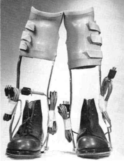 37 this case gave rise to several significant questions: 1. To what extent was the below-knee brace unweighting the foot during the period from heel contact to toe off? 2.